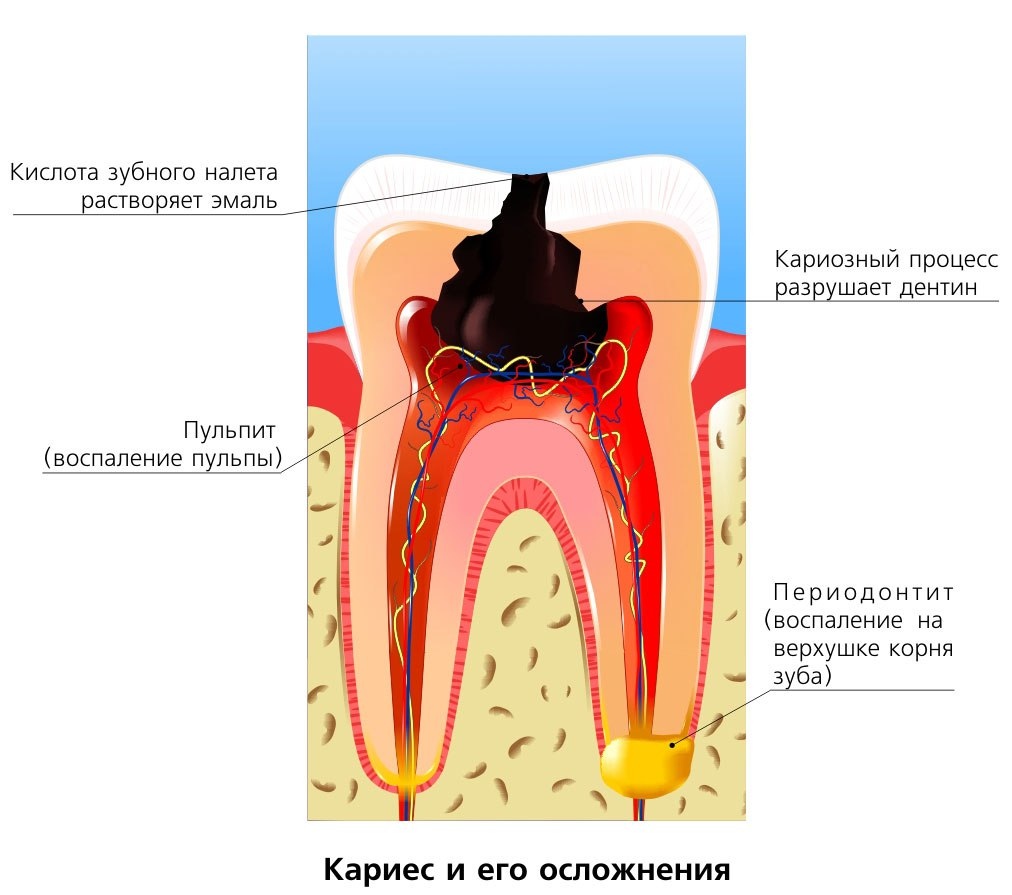 Полезно знать - Идеал-Денталь